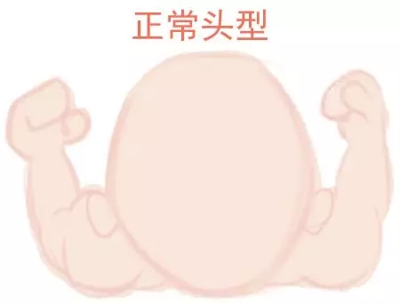宝宝圆头好照旧扁头好？？？这些神秘许多爸妈都不知道1.webp.jpg