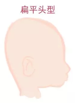宝宝圆头好照旧扁头好？？？这些神秘许多爸妈都不知道4.webp.jpg