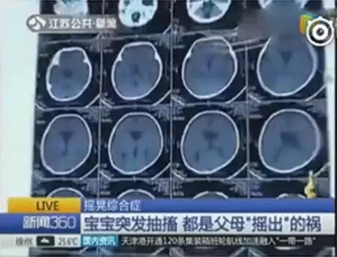 多名婴儿脑出血，，家长一个不经意的行动竟然对宝宝危险这么大1.webp.jpg